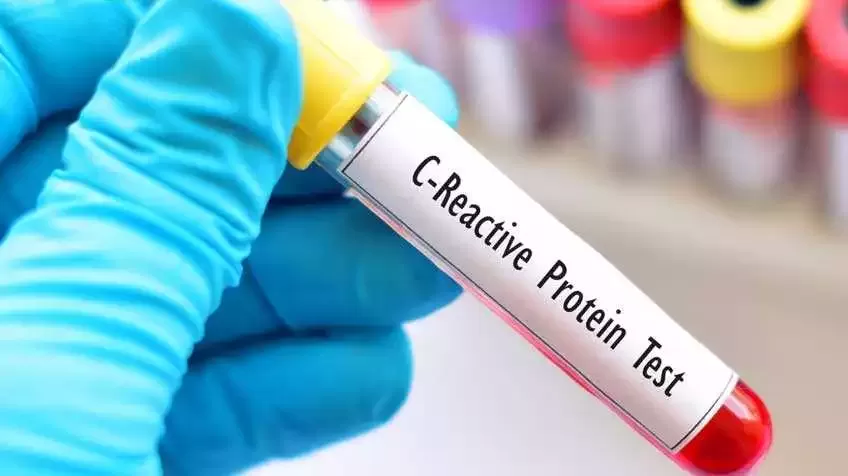 C-ռեակտիվ սպիտակուցի (CRP) թեստ