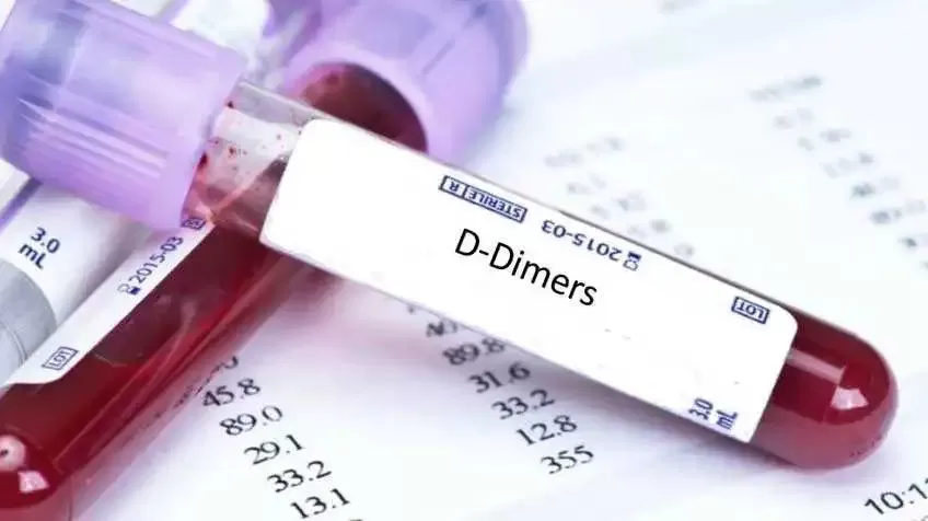 D-դիմերի թեստ