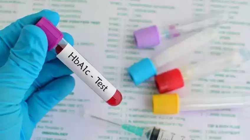 Գլիկոզիլացված հեմոգլոբինի (HbA1c) թեստ