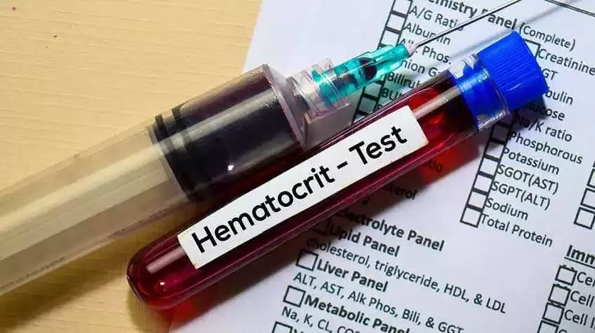 Հեմատոկրիտի (Ht կամ HTC) թեստ