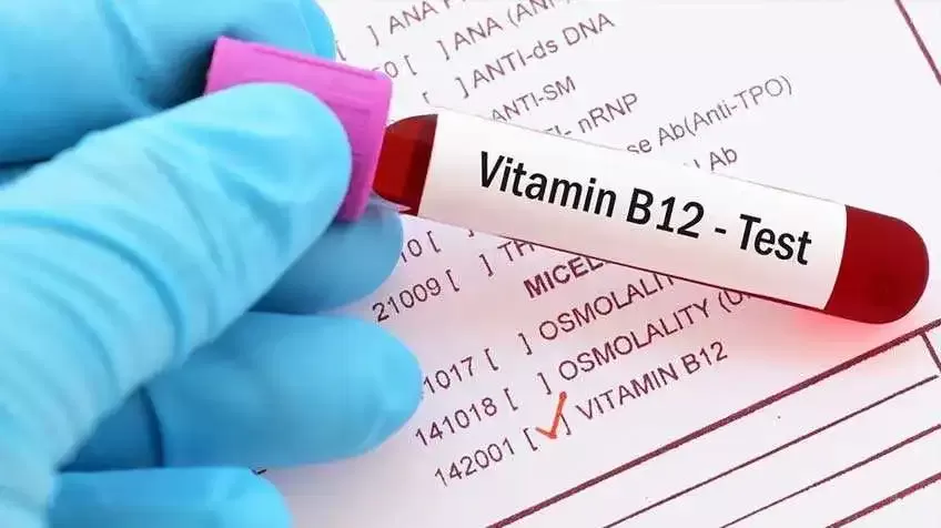 Վիտամին B12-ի թեստ
