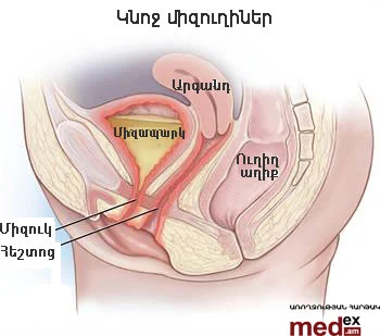 female-urinary-tract-illustration.jpg